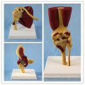 Human Knee Joint Model with Muscles and Ligaments for Medical Teaching